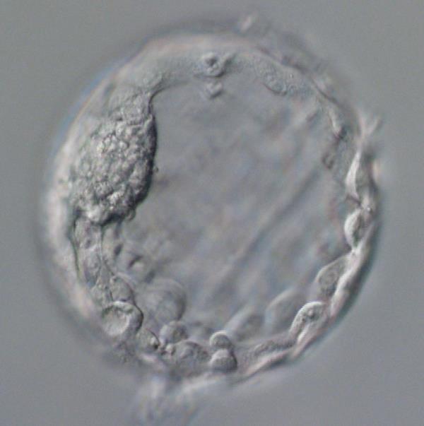 early human embryo under microscope